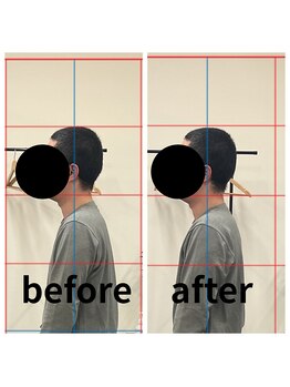 熊本カワル整体 JR上熊本駅院/首・肩の痛み