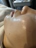 フェイシャル光脱毛