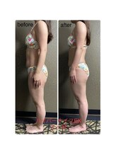 チュラ/ハイパーナイフ/所沢/痩身エステ