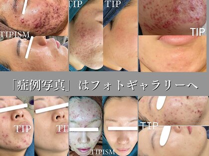 エル(Elle)の写真