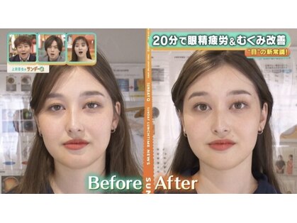 アイケアラボ 目黒店(アイケアLaBo)の写真