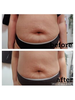 クリオネ(Clione)/スリム美姿勢メゾット