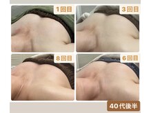 スナグル(Snuggle)/育乳バストアップ♪