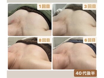 スナグル(Snuggle)/育乳バストアップ♪