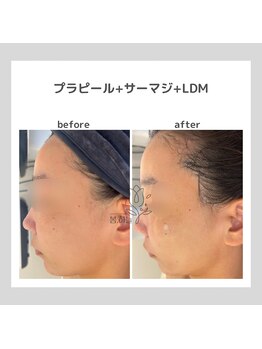 ポムハヌル 大阪梅田中崎町(pom.haneul)/韓国肌管理室