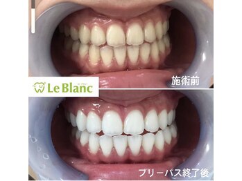 ルブラン 奈良店(Le Blanc)/定期的に沢山のお客様に