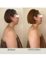 リーブル(LIBRE)/小顔コルギ　６回