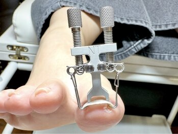 ルシャ(Le’chat)/巻き爪ケア