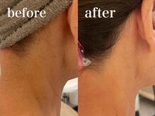 エンソワー(en'sower)/うなじシェービング