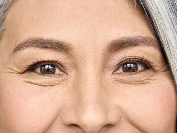 グラシア 宇土店(gracia)の写真/【40代以上の方必見★】目の下の気になる“ぷっくら”に。切らない《眼窩脂肪トリートメント》新登場！