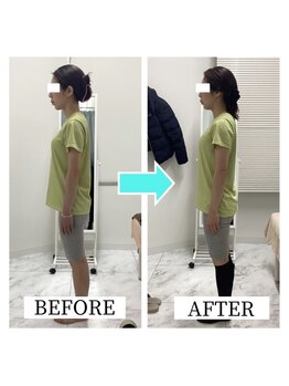 シンメトリー 千葉店/巻き肩・肩こり・猫背も改善