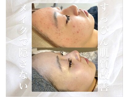 アンド(&.)の写真