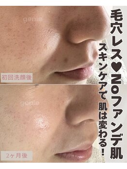 ジーニー(genie)/ラレステンスキンケア/韓国美容