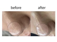 ユズドット(yuzu.)