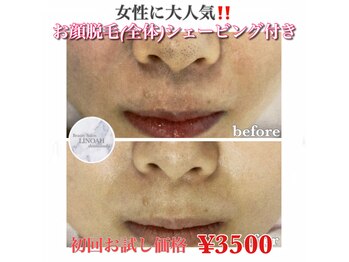 リノア 心斎橋店(LINOAH)/お顔脱毛(シェービング付き)