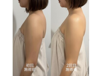 アンド(and...)の写真