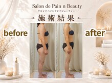 サロン ド ペイン アンド ビューティー(Salon de Pain n Beauty)の雰囲気（リラクゼーションの疲労改善も見た目改善(痩身)も結果重視！！）