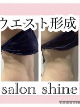 サロンシャイン(Salon Shine)/痩身エステ４０代