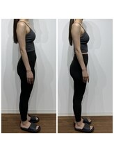 レナセール FUK 福岡店(RENACER FUK)/姿勢改善