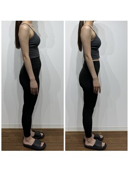 レナセール FUK 福岡店(RENACER FUK)/姿勢改善