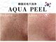 ヘティ バイ ソウル 中目黒(HETIY by Seoul)の写真/《韓国直輸入機器使用》韓国式毛穴洗浄*水光アクアピール☆毛穴に美容液導入◎内側から潤い溢れる水光肌○*