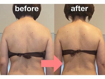 シャイン(shine)/デトックスリンパ120分 1回