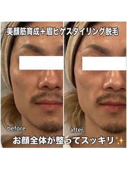 リエル(RIEL)/小顔矯正×美顔筋育成エステ