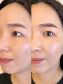 まつげのお悩み解決サロン