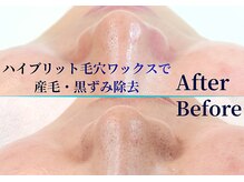 夏秋美肌サロンの雰囲気（変化する肌・毛穴へ。揺らぎ肌/エイジングケア/ブライダル◎）