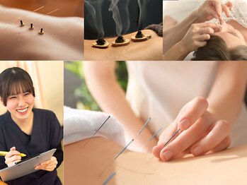 きたながのBJ整骨院の写真/【えっ?!鍼で人生が変わるかも!?】眼精疲労・くいしばり・リフトUP・頭痛・頭皮改善・肩こりOK!