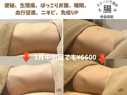 テセラ(Tethere)の写真