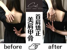 クレスト(CREST)の雰囲気（20代女性→猫背や巻肩のお悩みのデスクワークの女性！）