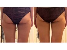 サロンドエムジョリー 横浜(Salon de M jolie)/お尻アップと脂肪燃焼に超絶効果