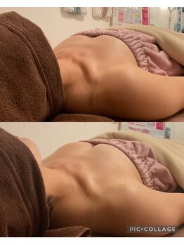 アネラ 京都駅前店(Anela)/【Before & After 】