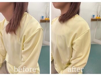 カイロラインメディカル整体 平塚院(Chiro Line)/肩こり×猫背矯正/beforeafter