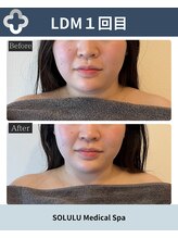 ソルル(SOLULU)/二重顎撃退！