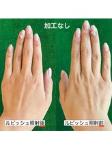 リリー(Lilly)/ルビッシュ