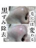 【どのメニューがいいか分からない…】メニューご相談用クーポン！