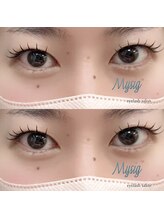 ミューシグ(Mysig)/エクステ