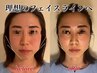 【残り3名様】小顔矯正＆美顔矯正　通常9900円→1980円(60分)
