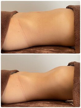 ヨロ(YOLO)/パーソナルボディケア90分