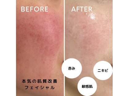 フェイエール鍼灸院 ラスィーヌ(fier鍼灸院 racine)の写真