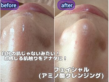 スノードロップ(snowdrop)/