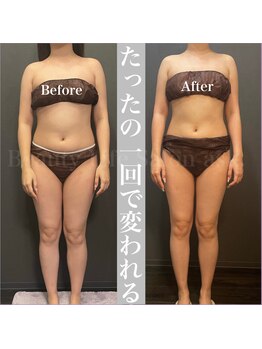 アスク 池袋 大塚駅店(ask.)/たった1回の施術で変わる