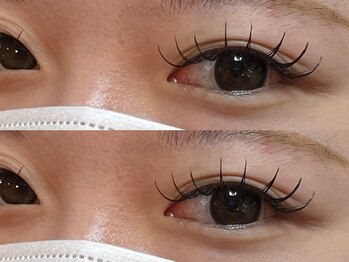 ナナリスボン 福岡(NANA LISBON)/フラット160本