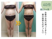 ヨサパーク ミミ 高野店(YOSA PARK mimi)/ビフォーアフター