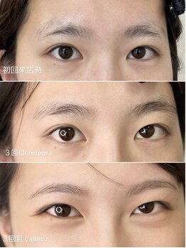 テオン(teon)/眉毛は回数を重ねる程、美眉に♪