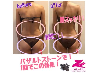 ウェルフィットの写真