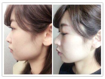 ラ アクサル(la.akthar)/小顔 骨格矯正 ヘッドスパ