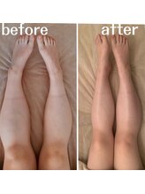 マリーゴールド(marigold)/脚のデトックス